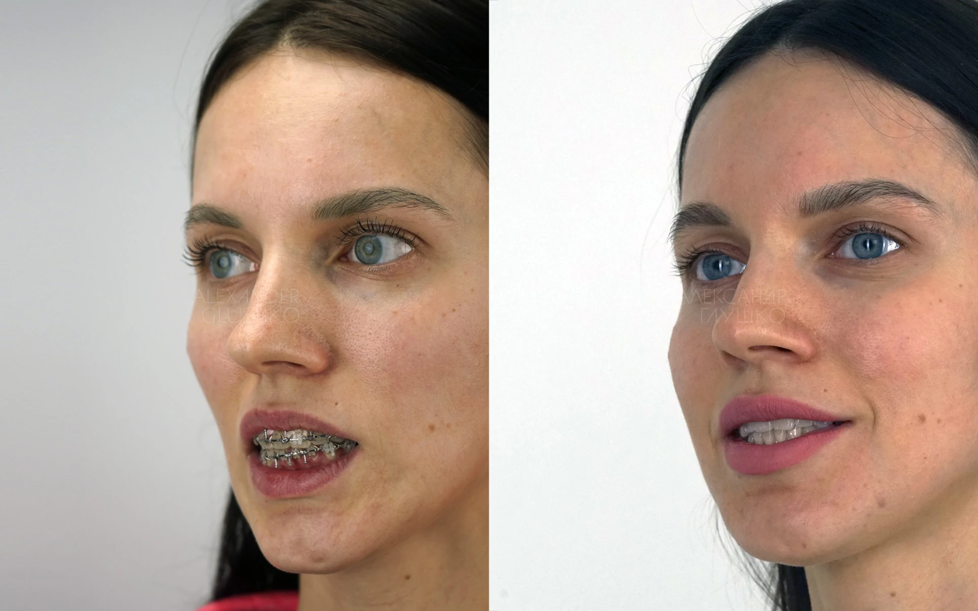 Ортогнатия