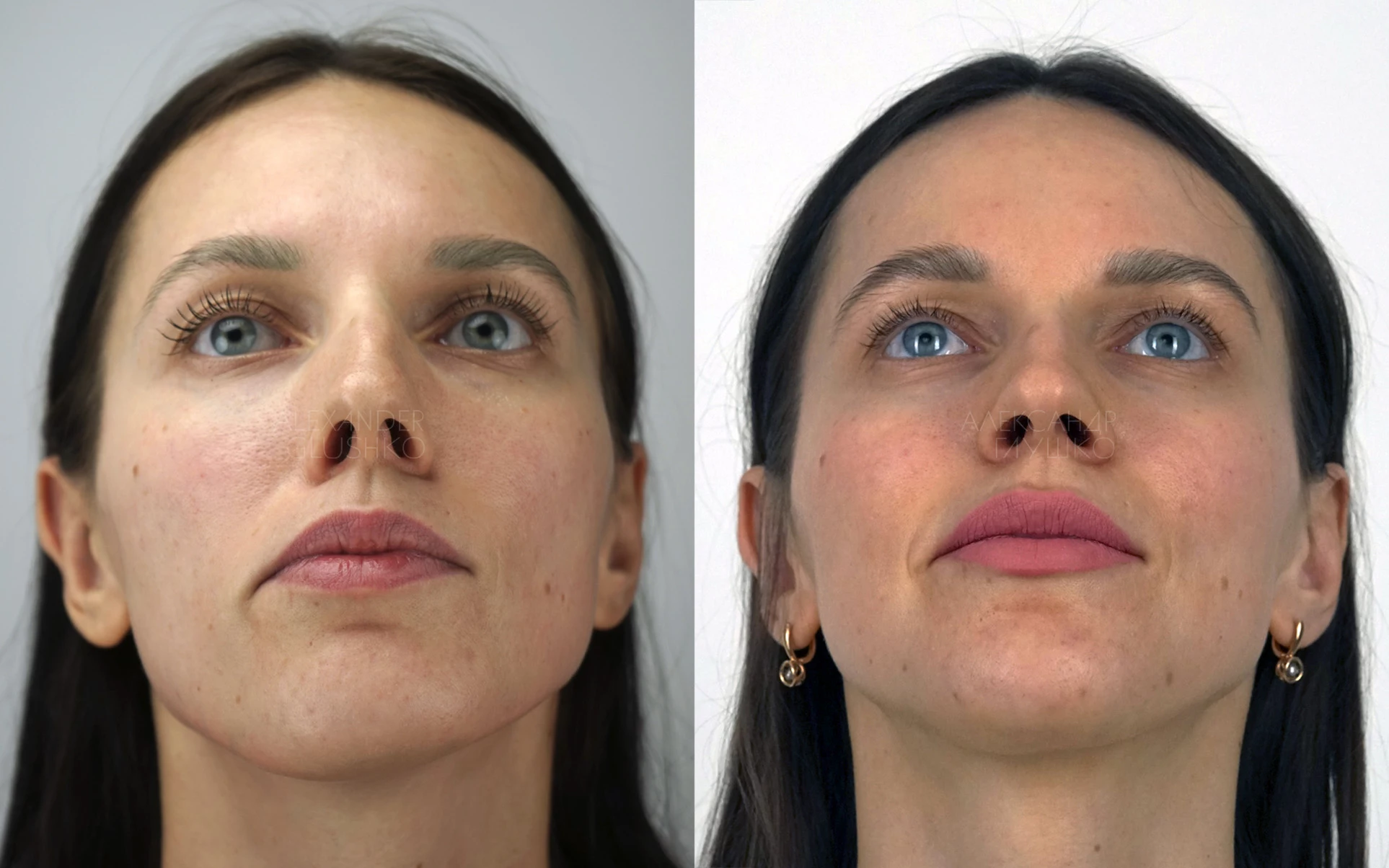 Ортогнатия