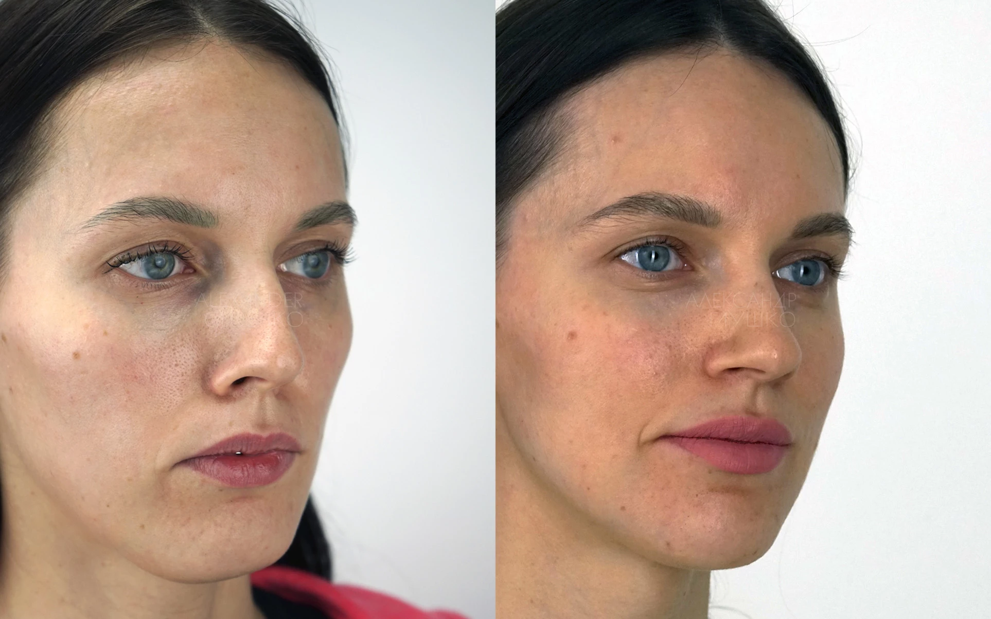 Ортогнатия