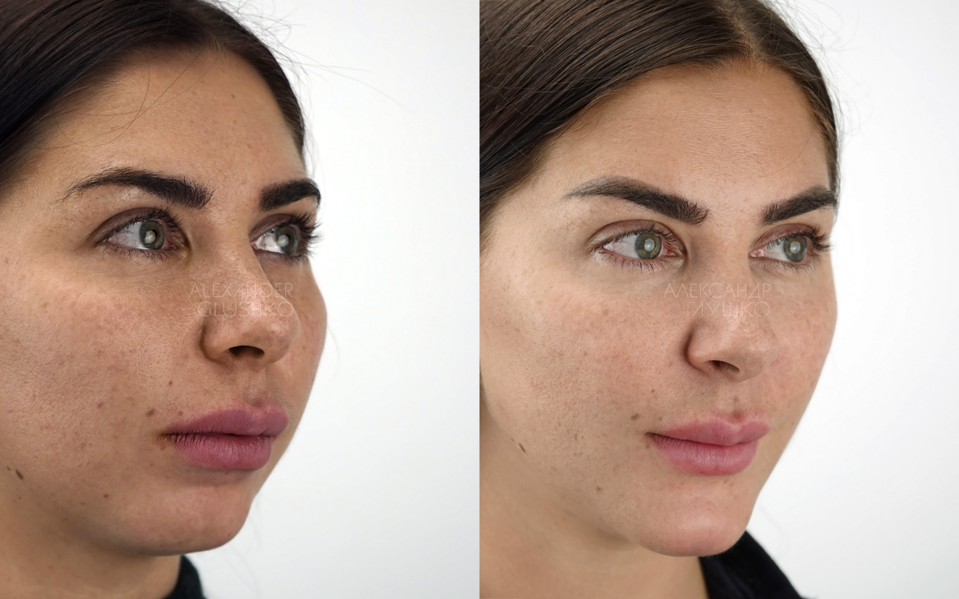 Ортогнатия