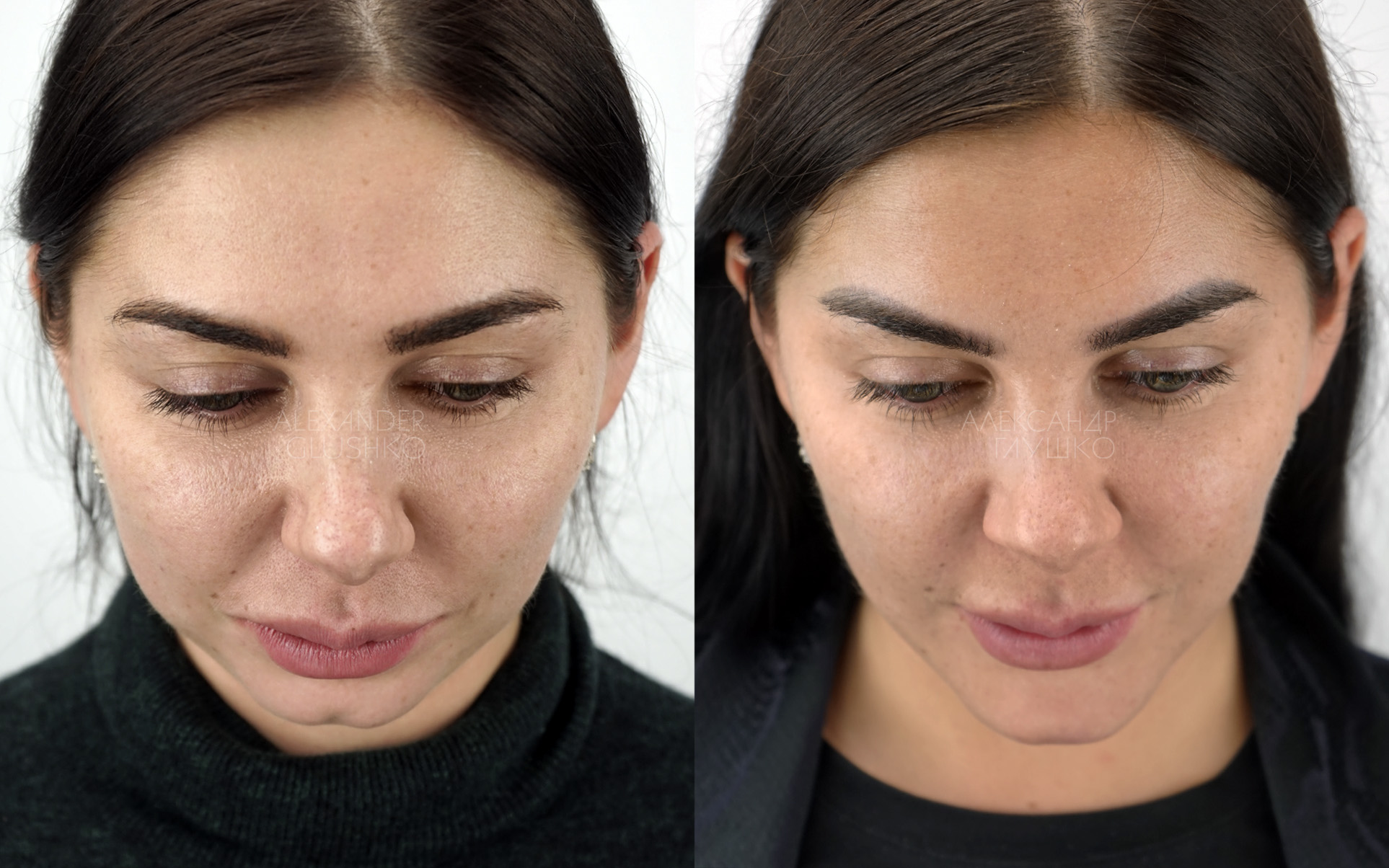 Ортогнатия