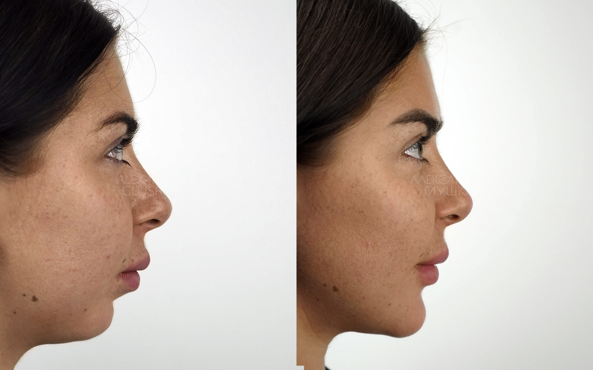 Ортогнатия